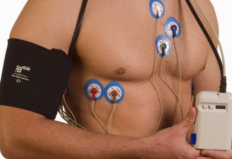 O que é Cardio Looper - Monitor de Eventos Sintomáticos